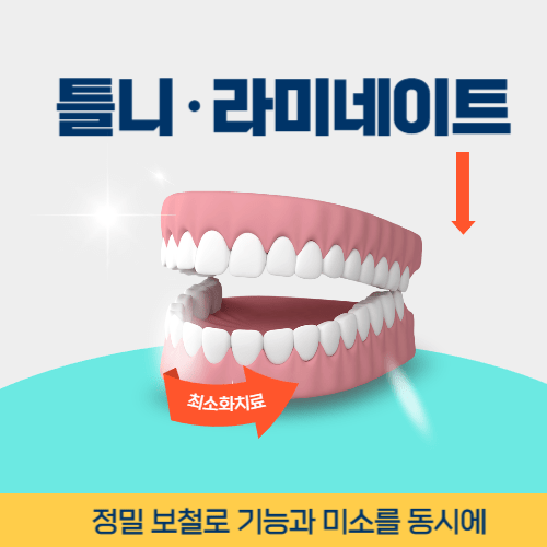 안산치과 안산시 치과 틀니 라미네이트