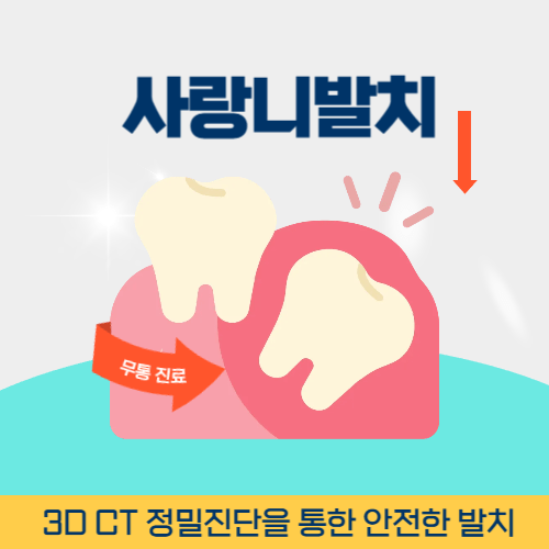 안산치과 안산시 치과 사랑니 발치