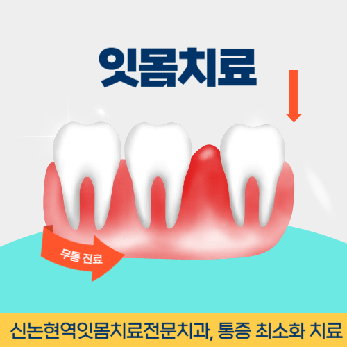 안산치과 안산시 치과 잇몸치료
